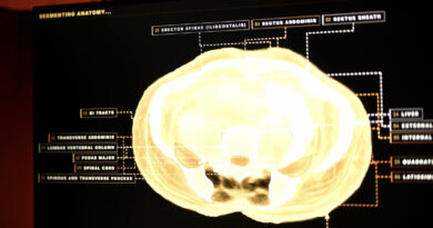 Midjourney, The AI Image Generator, Is Developing A Full-Body Ultrasonic Scanner
